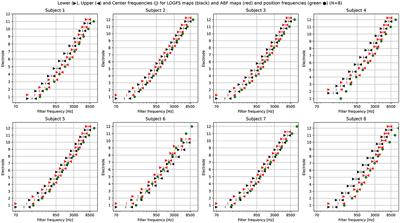 Does it make any sense to fit cochlear implants according to the anatomy-based fitting? Our experience with the first series of patients